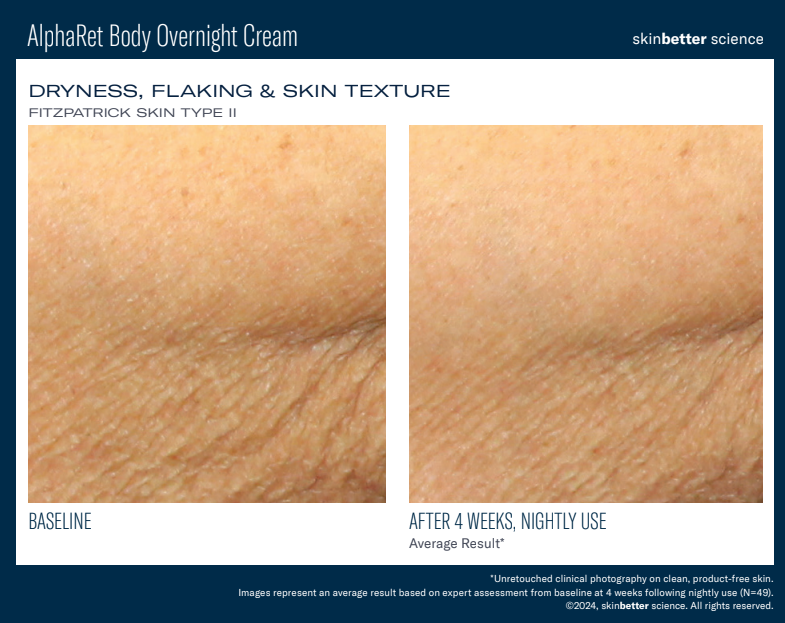 AlphaRet BODY Overnight Cream