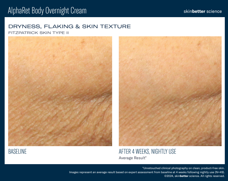 Skin Better AlphaRet **BODY Overnight Cream **